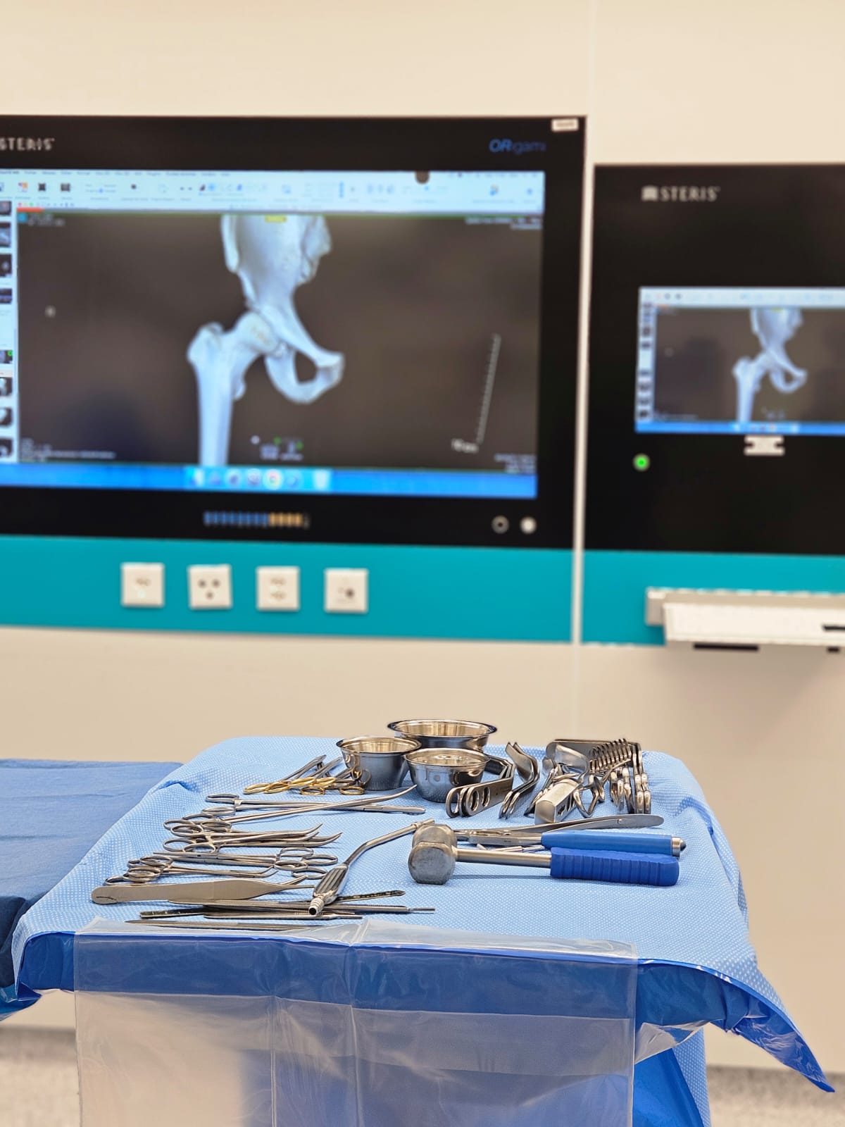 Surgical instruments and hip X-ray monitors